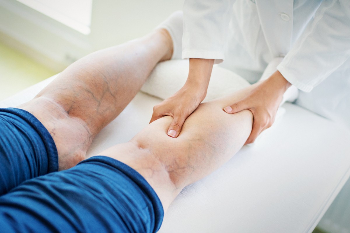 Sestřička masíruje lýtko pacienta s křečovými žilami