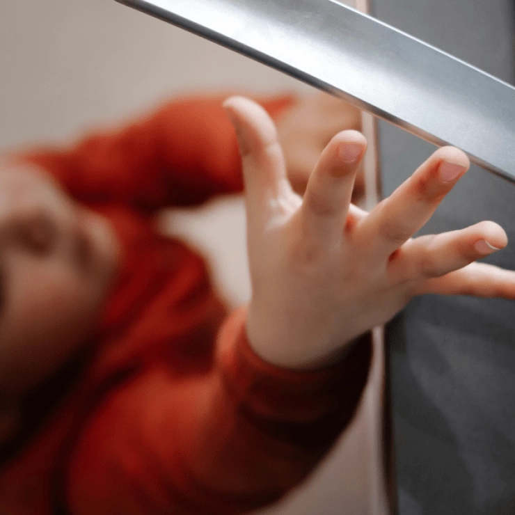 Ruka malého dítěte s popáleninou vyžadující správné ošetření