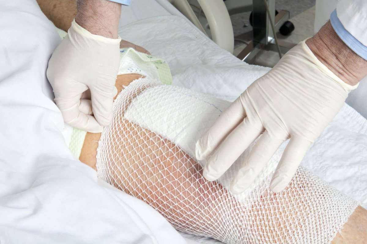 Pooperační noha s síťovým hadicovým obvazem připravená k péči